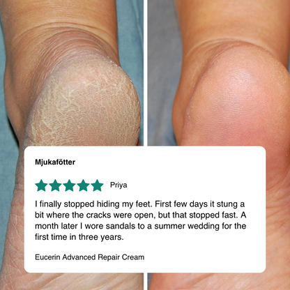 Eucerin Advanced Repair Cream